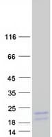 Human UQCRHL Protein (Recombinant Myc-DDK (Flag))