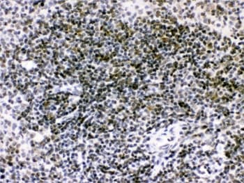 RAG2 / RAG-2 Antibody