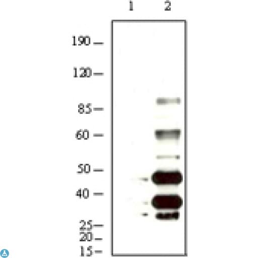 HHV-8 K8 alpha Antibody