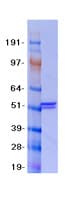 Human MLYCD / MCD Protein (Recombinant Myc-DDK (Flag))