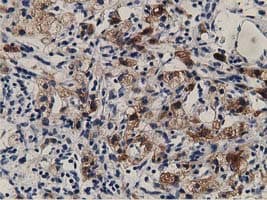ALDH1L1 Antibody (clone OTI3D2)