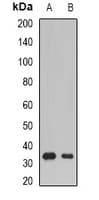 SSX5 Antibody