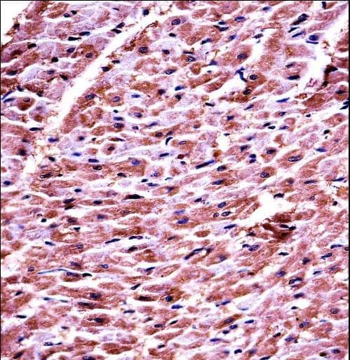 Polyclonal Rabbit anti-Human DHRS7C Antibody (aa116-145, IHC, WB)