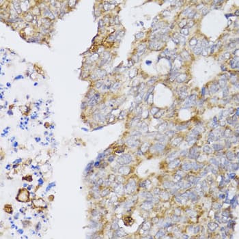 Polyclonal Rabbit anti-Human CCN5 Antibody (IHC, WB)