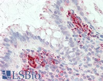 IHC-plus™ IL3RA / CD123 Antibody