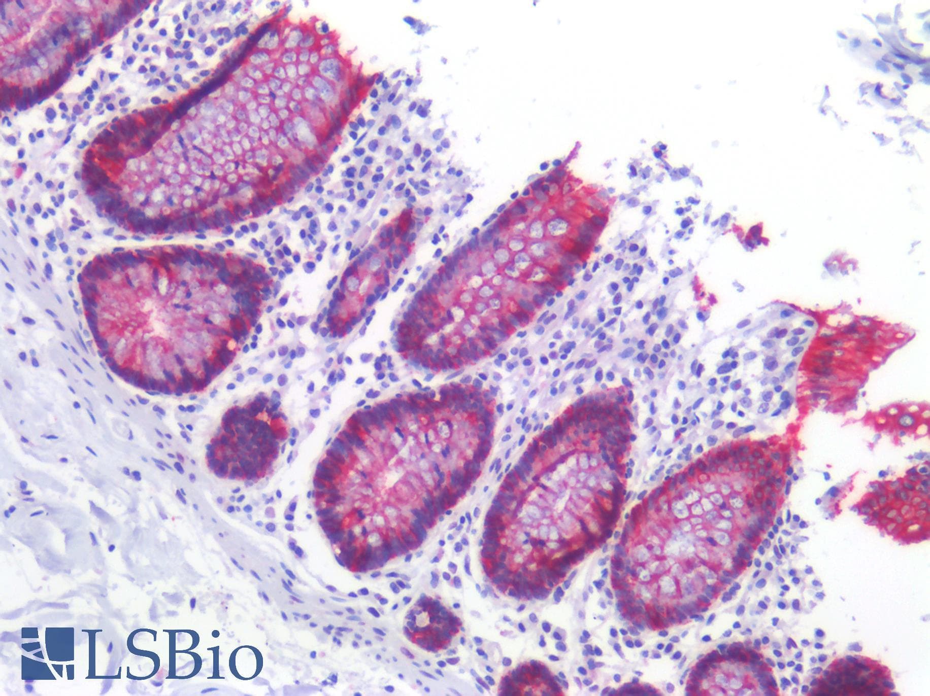 PathPlus™ CLDN4 / Claudin 4 Antibody (C-Terminus)