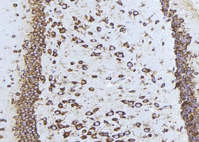 Polyclonal Rabbit anti-Human TAOK1 / TAO1 Antibody (IHC, IF, WB)