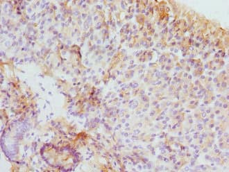 EIF2S3 / EIF2G Antibody