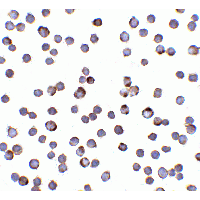Polyclonal Rabbit anti-Human CRADD / RAIDD Antibody (IHC, IF, WB)