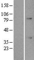 Human ATF1 Protein (Over-Expression Lysate Myc-DDK (Flag))