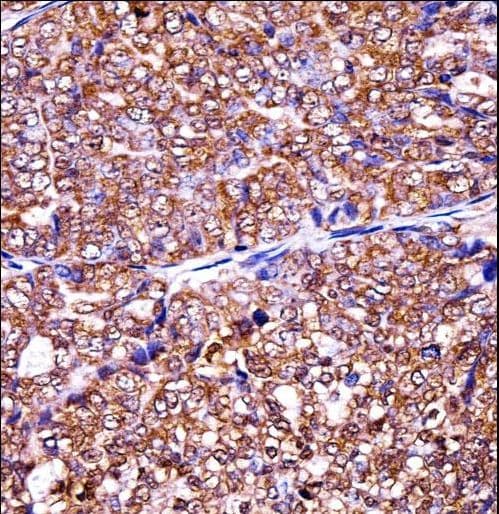 Polyclonal Rabbit anti-Human EIF5A2 Antibody (aa93-122, IHC, WB)