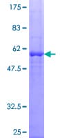 Human Dexras1 / RASD1 Protein (Recombinant GST)