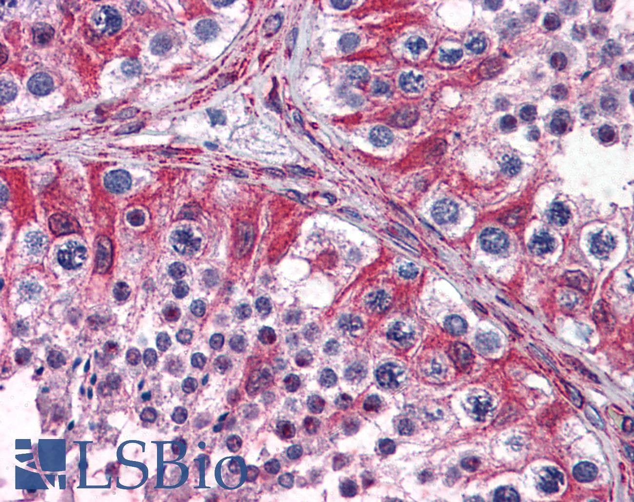 IHC-plus™ PACE4 / PCSK6 Antibody (aa830-841)