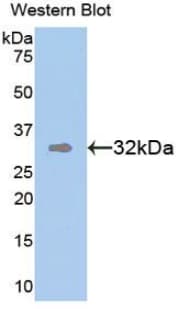 TMEFF1 / Tomoregulin 1 Antibody (aa79-333)