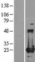 FTH1 / Ferritin Heavy Chain Protein (Over-Expression Lysate Myc-DDK (Flag))