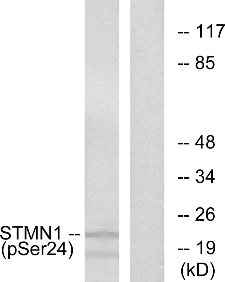 STMN1 / Stathmin / LAG Antibody (phospho-Ser24)