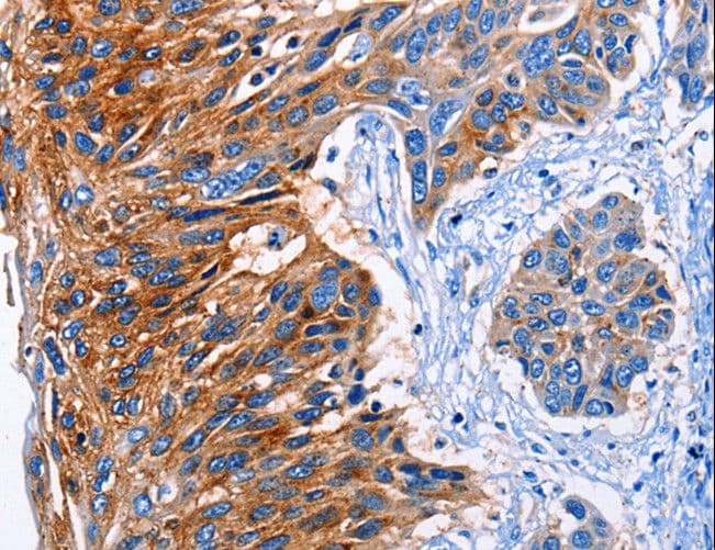 Polyclonal Rabbit anti-Human CLEC2B / AICL Antibody (IHC)