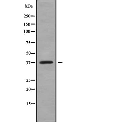 AKR1C4 / Chlordecone Reductase Antibody