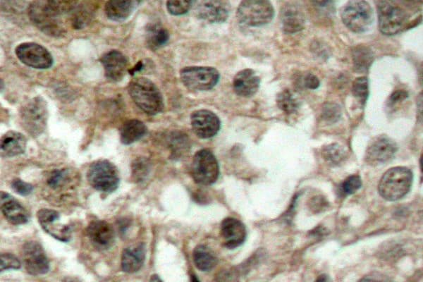 FOXO3 / FOXO3A Antibody (Pro247)