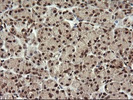 FAM164A / CGI-62 Antibody (clone OTI4B5)
