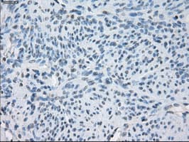 FCGR2 / CD32 Antibody (clone OTI6D11)