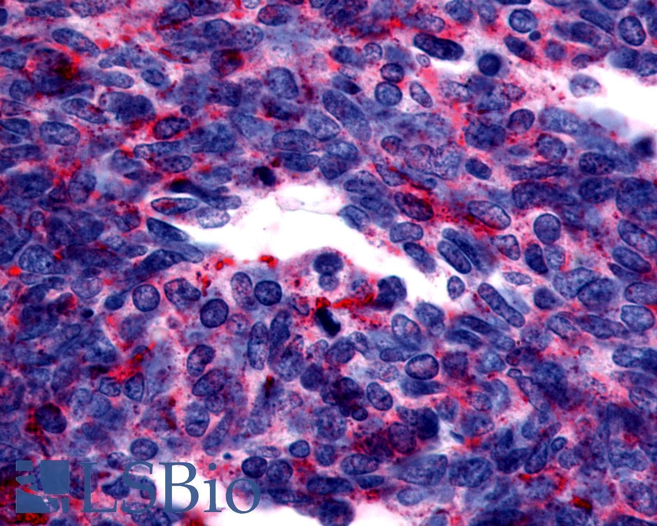 PathPlus™ Polyclonal Rabbit anti-Human GPER1 / GPR30 Antibody (Cytoplasmic Domain, IHC, IF, WB)