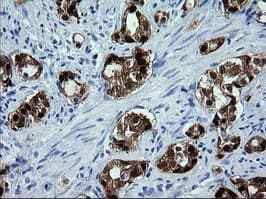 CMPK / CMPK1 Antibody (clone OTI1D7)