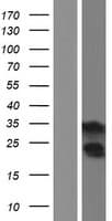 Human TNNT1 / TNT Protein (Over-Expression Lysate Myc-DDK (Flag))