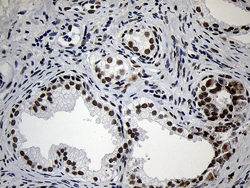 Monoclonal Mouse anti-Human ZNF670 Antibody (clone OTI3E1, IHC, WB)