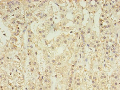 GABRA4 Antibody (aa36-258)