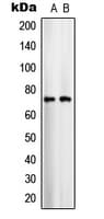SLC25A12 / ARALAR Antibody (Internal)