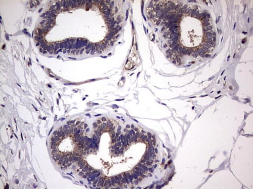 BFSP1 / Filensin Antibody (aa405-665, clone OTI3H6)