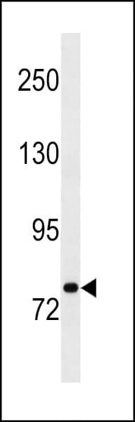 STAT3 Antibody (aa4-31)