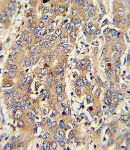 PIGR Antibody (aa646-672)
