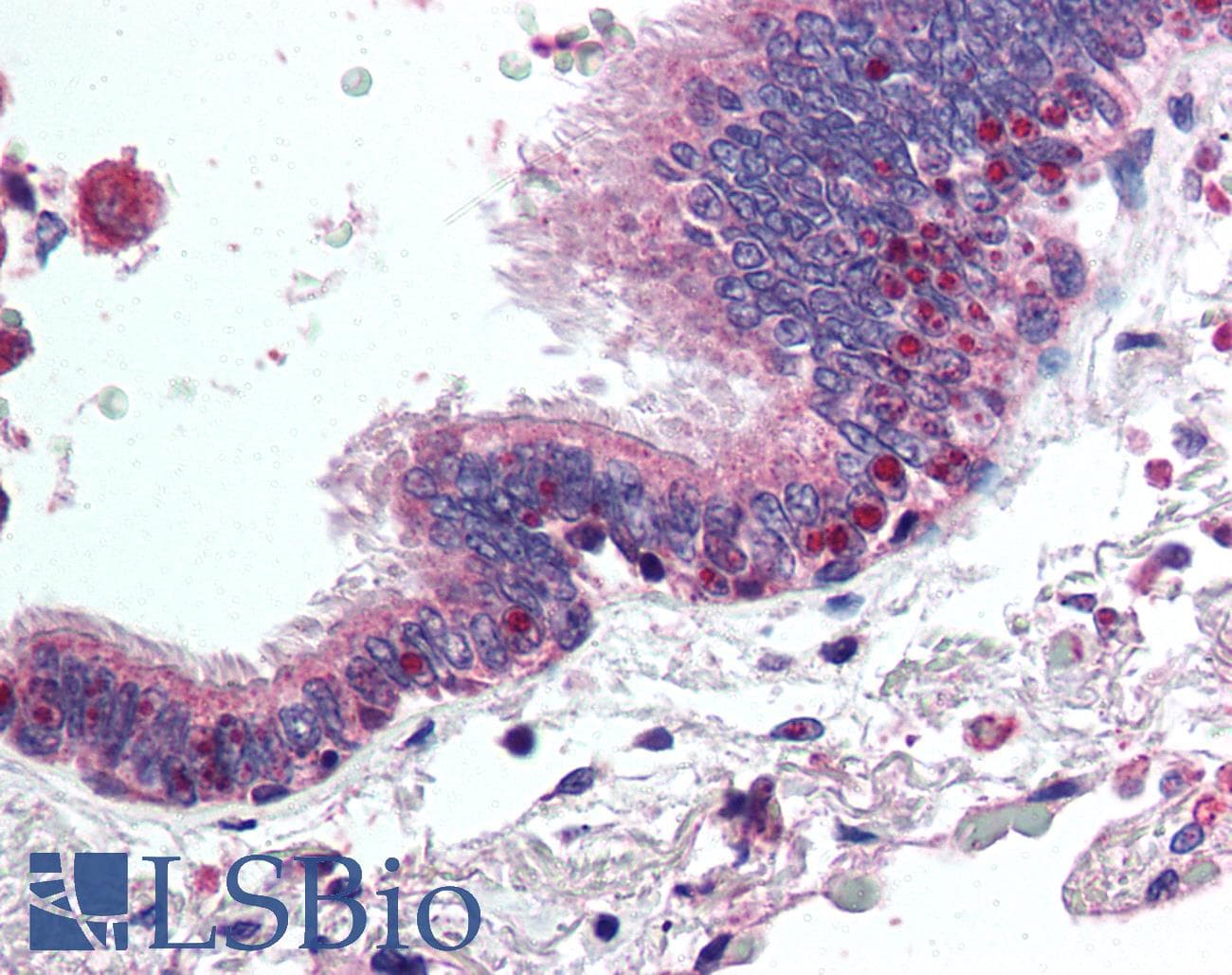 IHC-plus™ Polyclonal Rabbit anti-Human HDAC4 Antibody (aa194-209, IHC, WB)