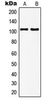 Polyclonal Rabbit anti-Human GRM7 / MGLUR7 Antibody (C-Terminus, WB)