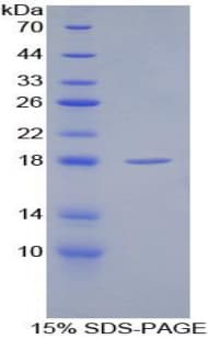 Rat SFRP1 Protein (Recombinant His)