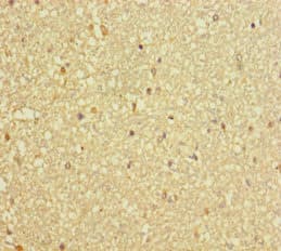 Dynactin 3 / DCTN3 Antibody (aa2-176)