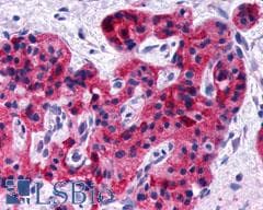 PathPlus™ Polyclonal Rabbit anti-Human GLP1R / GLP-1 Receptor Antibody (N-Terminus, IHC, IF, WB)