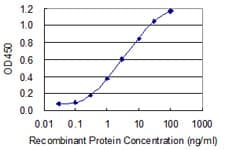 IHC-plus™ ATP6V1A1 / ATP6V1A Antibody (clone 4F5)