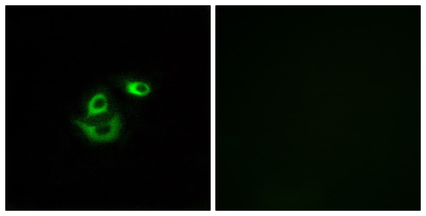 CLCC1 Antibody (aa391-440)