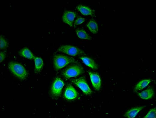 GPX4 / MCSP Antibody