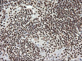 Monoclonal Mouse anti-Human SAE1 Antibody (clone 1G8, Carrier-free, IHC, IF, WB)
