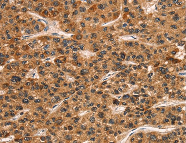 KLRC1 / NKG2A / CD159a Antibody