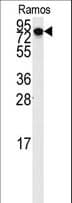 HURP / DLGAP5 Antibody (aa1-30)