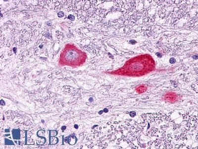 PathPlus™ Polyclonal Rabbit anti-Human GPR151 Antibody (Cytoplasmic Domain, IHC)