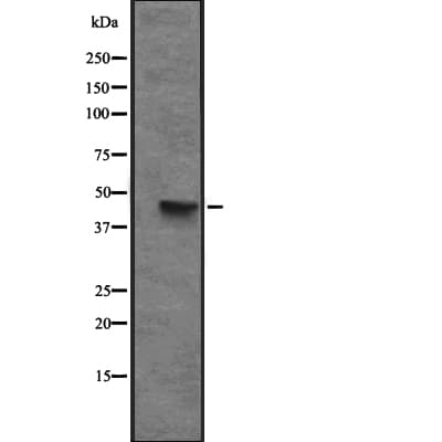 CXCR6 Antibody
