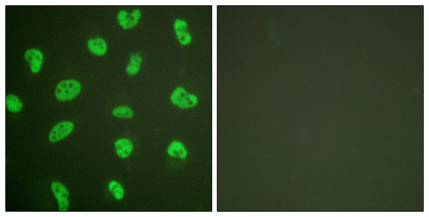 PRKDC / DNA-PKcs Antibody