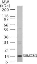 IHC-plus™ Polyclonal Rabbit anti-Human SUMO2 + SUMO3 Antibody (IHC, WB)
