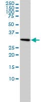 IHC-plus™ SNRPA / U1A Antibody (clone 3F9-1F7)